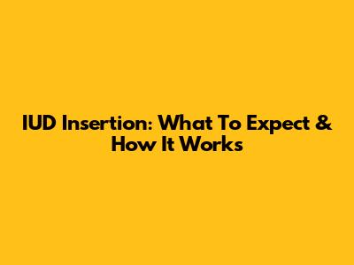 IUD Insertion: What To Expect & How It Works