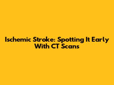 Ischemic Stroke: Spotting It Early With CT Scans