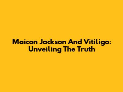 Maicon Jackson And Vitiligo: Unveiling The Truth
