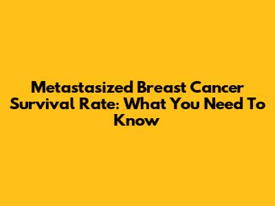 Metastasized Breast Cancer Survival Rate: What You Need To Know