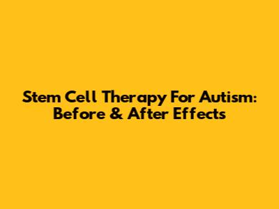 Stem Cell Therapy For Autism: Before & After Effects