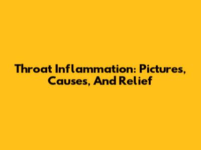Throat Inflammation: Pictures, Causes, And Relief